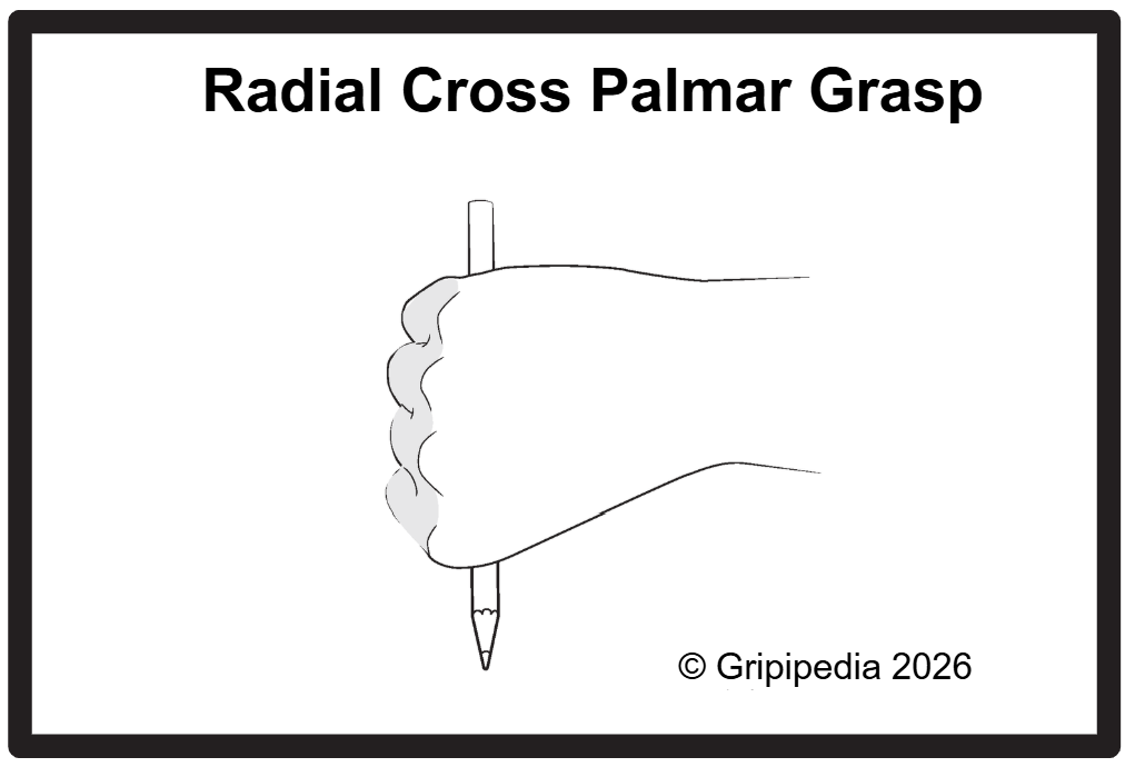 Radial Cross Palmar Grasp Right